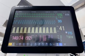 India ECG Machines Market Outlook to 2030
