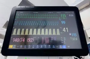 India ECG Machines Market Outlook to 2030