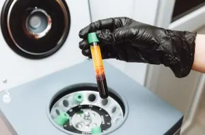 Singapore Centrifuges Market Outlook to 2030