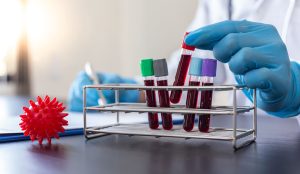 Indonesia Blood Testing Market Outlook to 2030