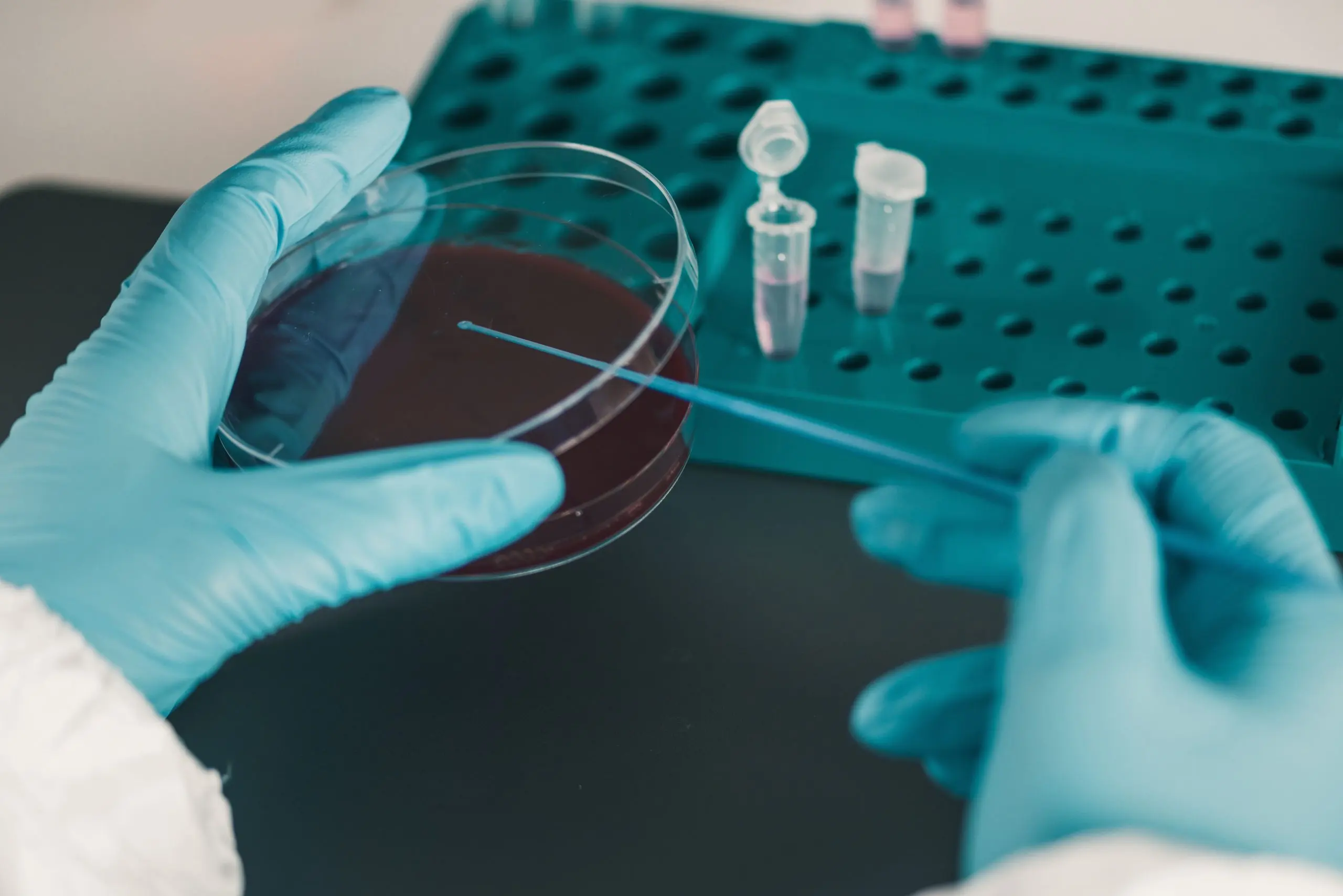 UAE In Vitro Diagnostics (IVD) Market Outlook 2030 UAE-In-Vitro-Diagnostics-IVD-Market-scaled