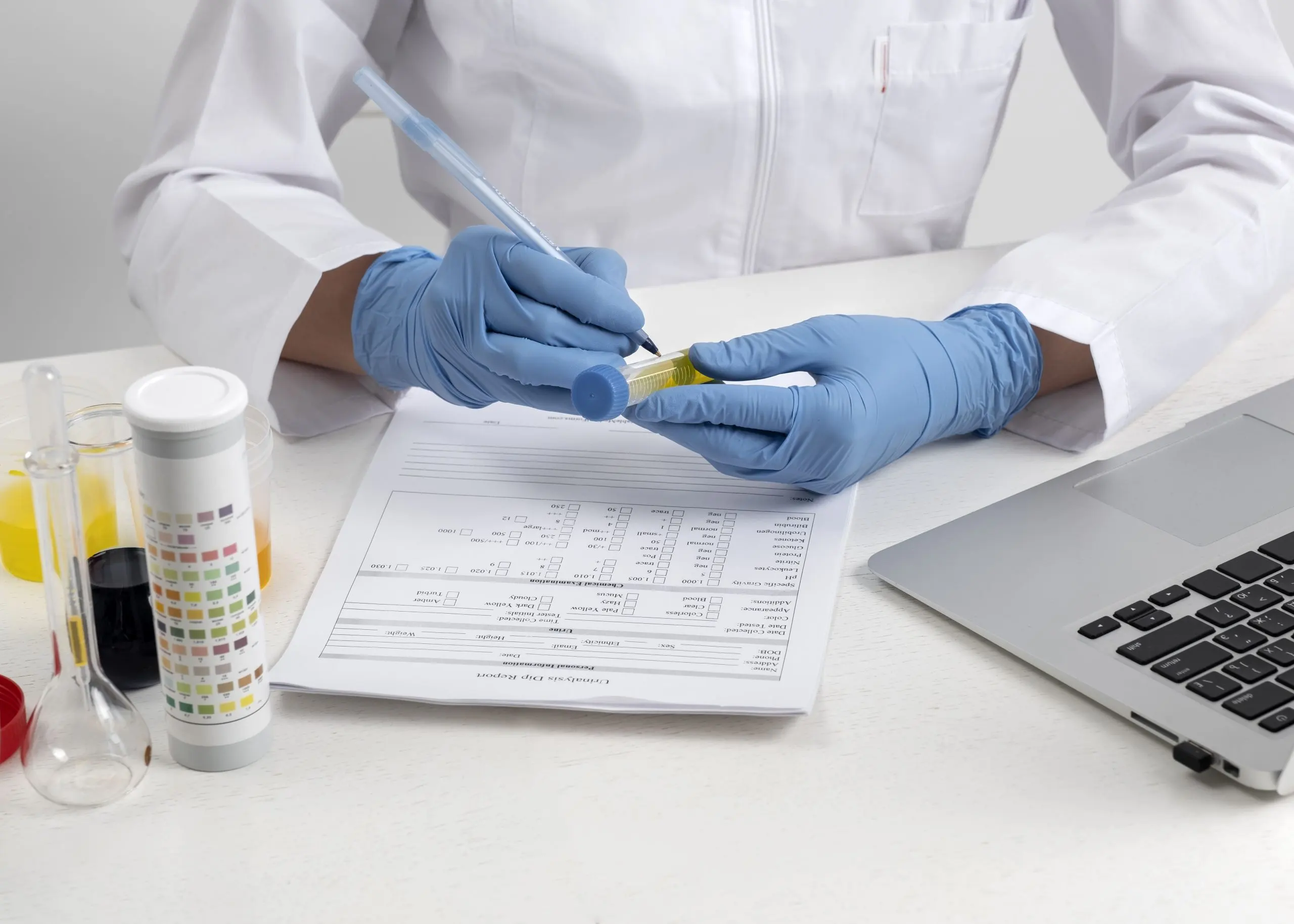 Philippines Lipid Profiles Testing Market Outlook to 2030 lab-doctor-performing-medical-exam-urine-1-scaled