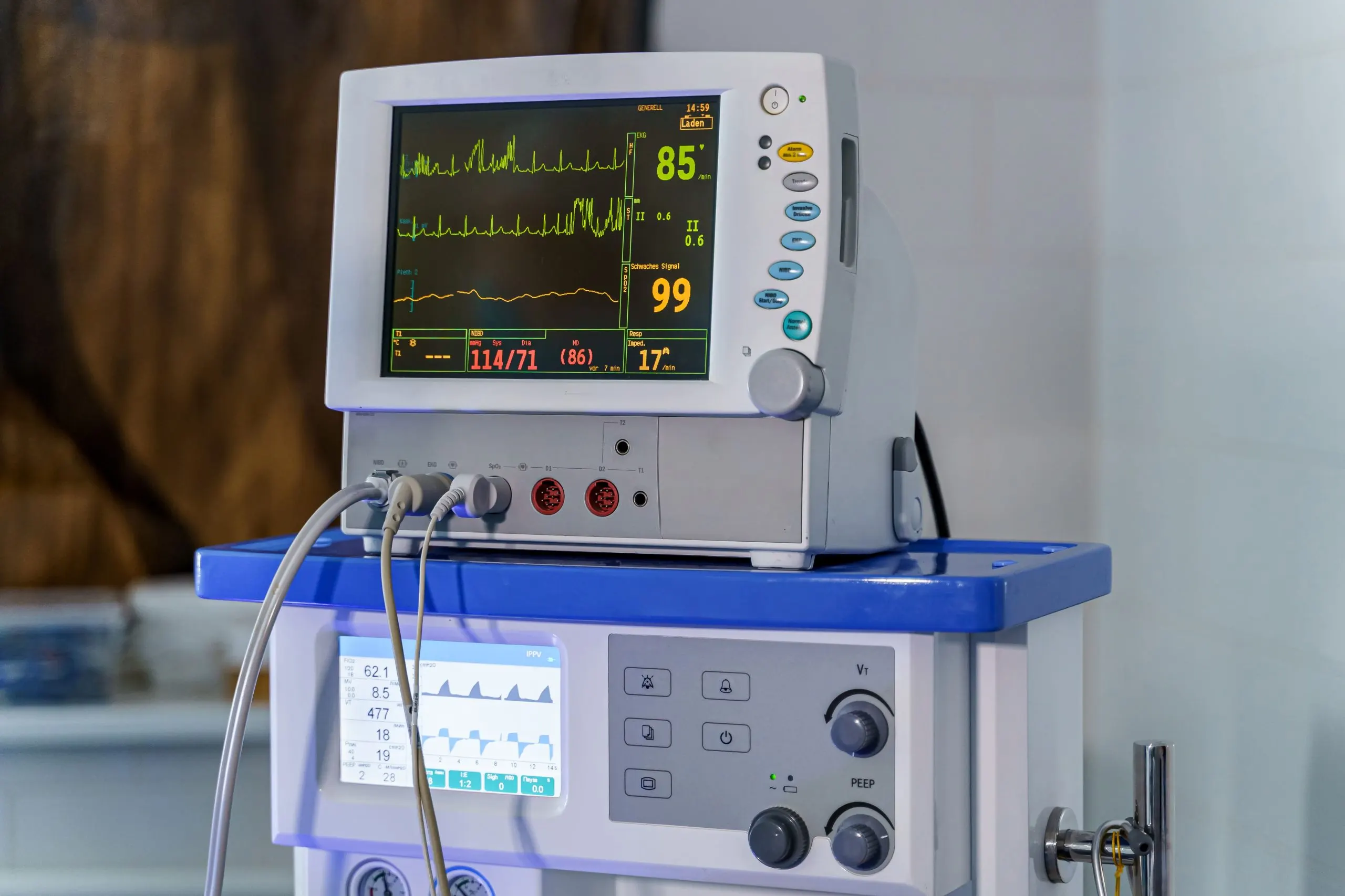 USA Echocardiography Equipment Market Outlook to 2030 monitor-with-results-it-diagnosing-patient-lungs-ventillation-equipment-1-scaled