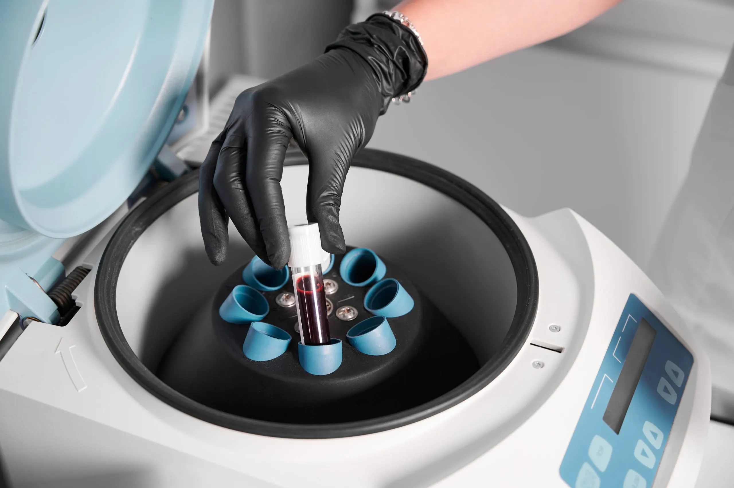 Philippines Ketone Testing Devices Market Outlook 2030 preparation-blood-injections-cosmetologist-puts-tube-blood-centrifuge-1-scaled