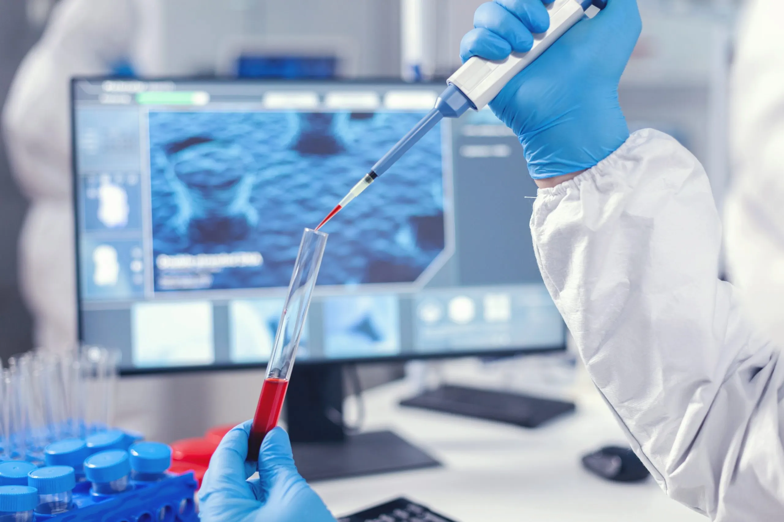 South Africa Diagnostic Labs Market Outlook to 2035 medical-researcher-dripping-blood-into-test-tube-from-micropipette-doctor-working-with-various-bacteria-tissue-pharmaceutical-research-antibiotics-against-covid19-scaled