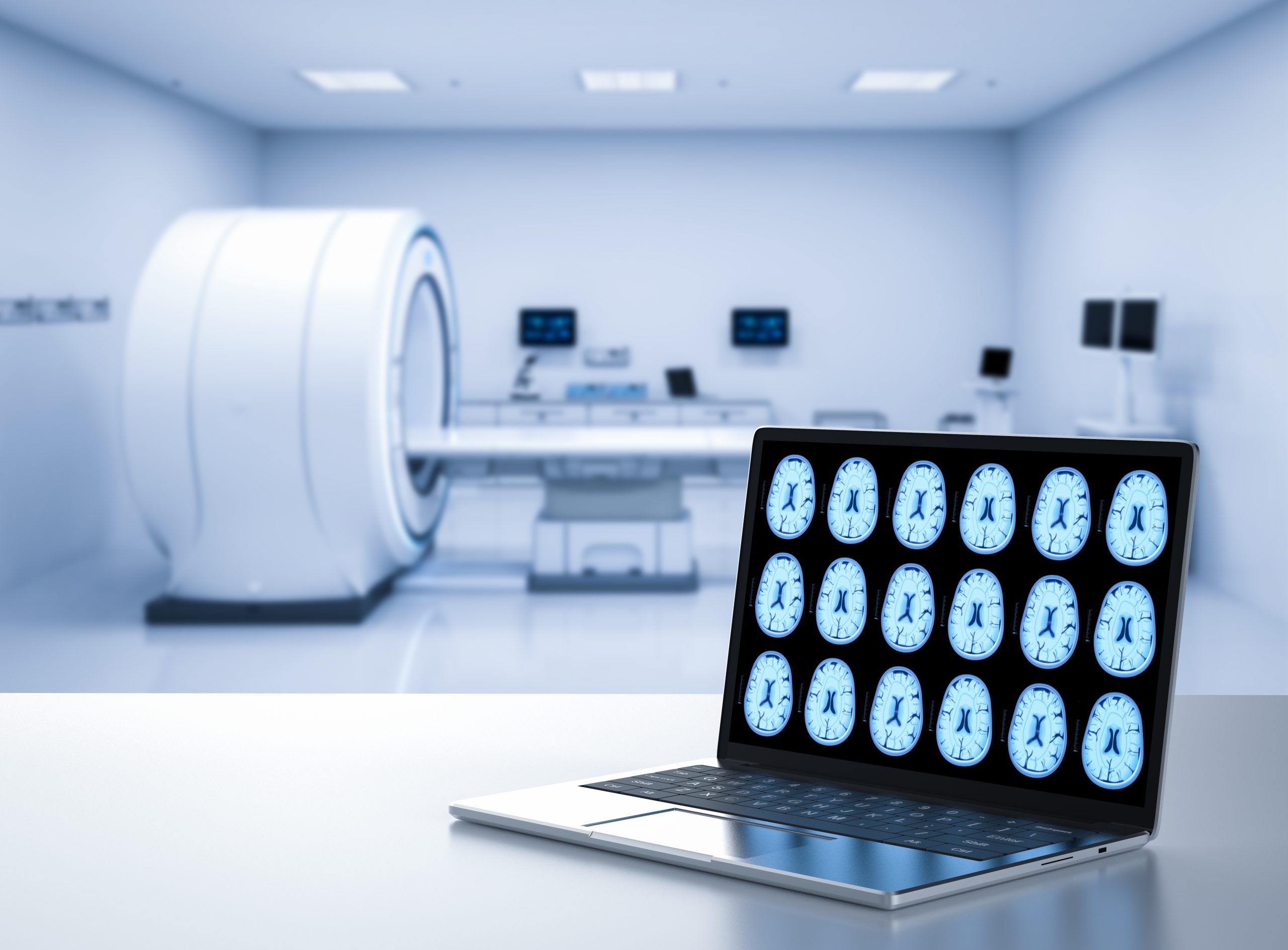 3d-rendering-computer-notebook-display-x-ray-brain-mri-lab-scaled