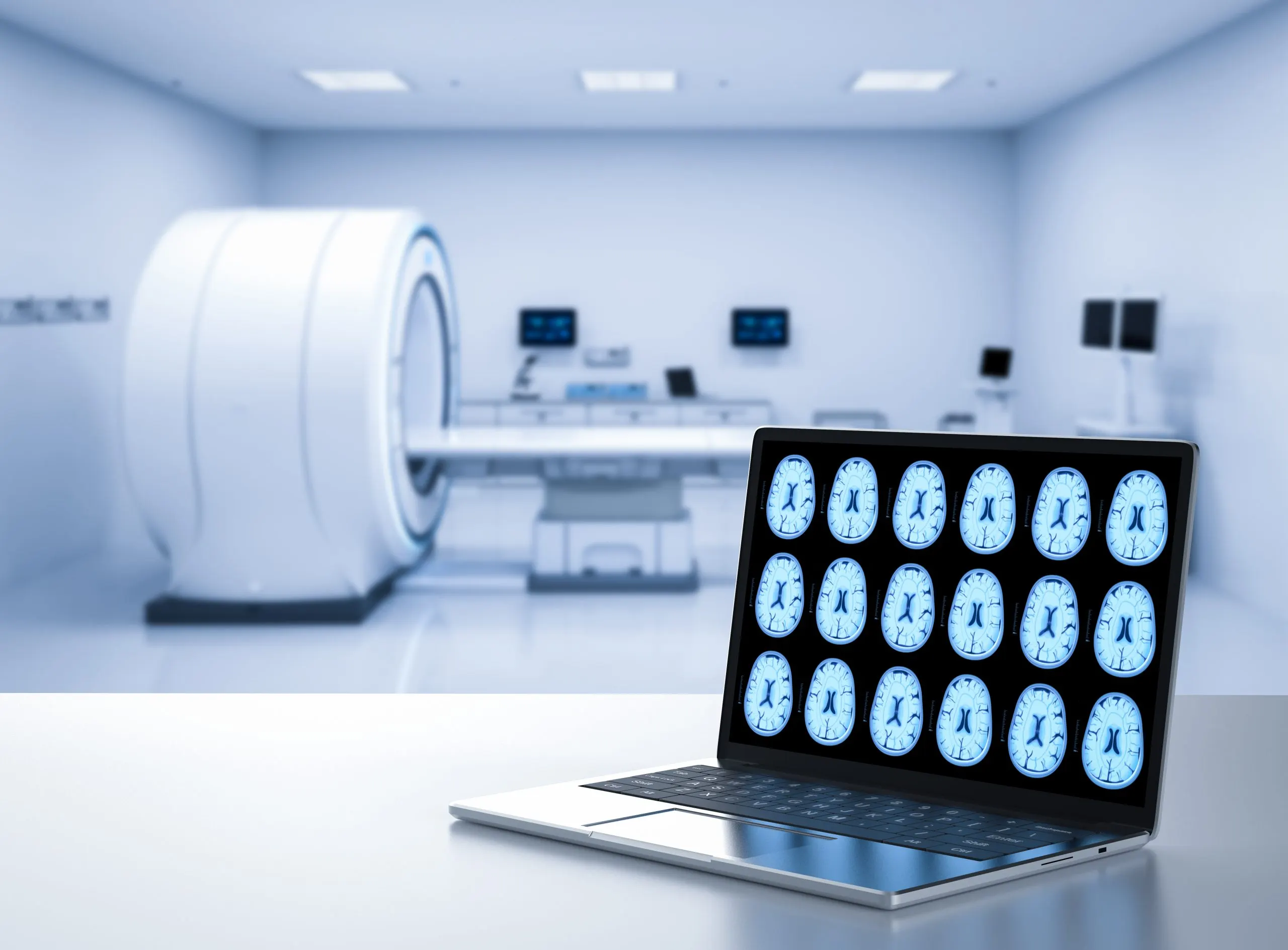 Philippines Brain SPECT Equipment Market Outlook to 2035 3d-rendering-computer-notebook-display-x-ray-brain-mri-lab-scaled