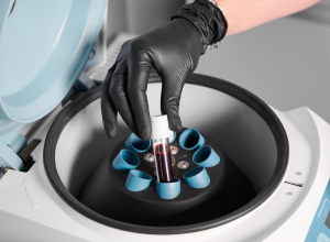 Philippines Cell Therapy Market outlook 2035