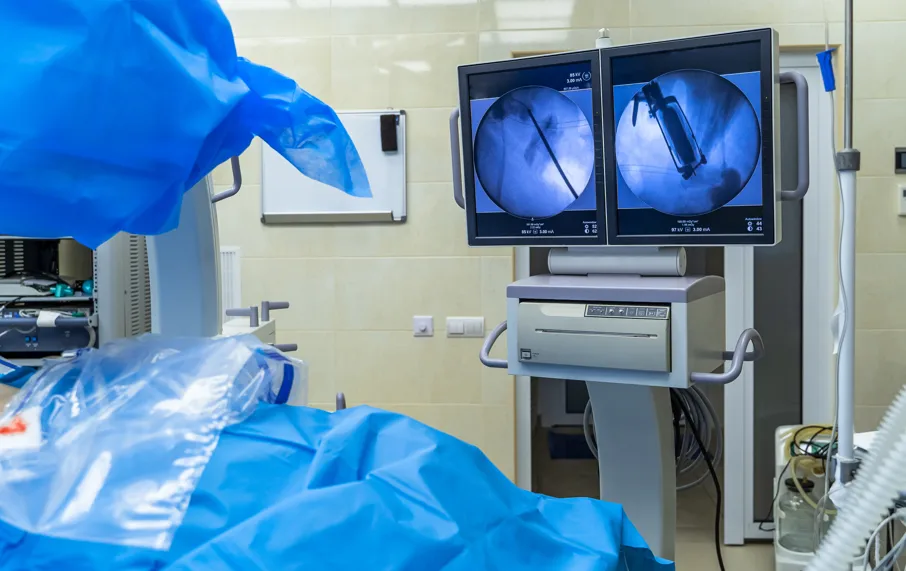 Philippines Pulmonary Angiography Equipment Market Outlook 2035 Philippines-Pulmonary-Angiography-Equipment-