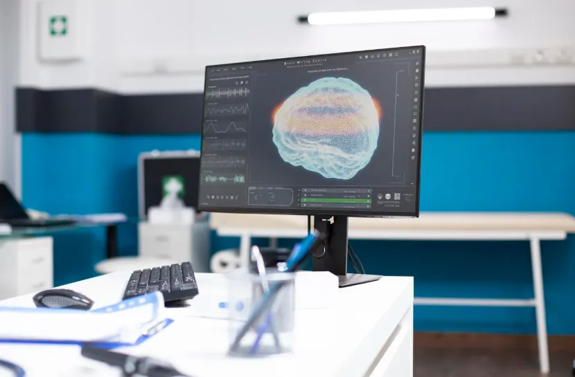 UAE Cerebral Angiography Equipment Market Outlook to 2035 UAE-Cerebral-Angiography-Equipment-Market