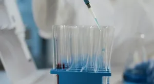 UAE Laboratory Pipettes Market Outlook 2035