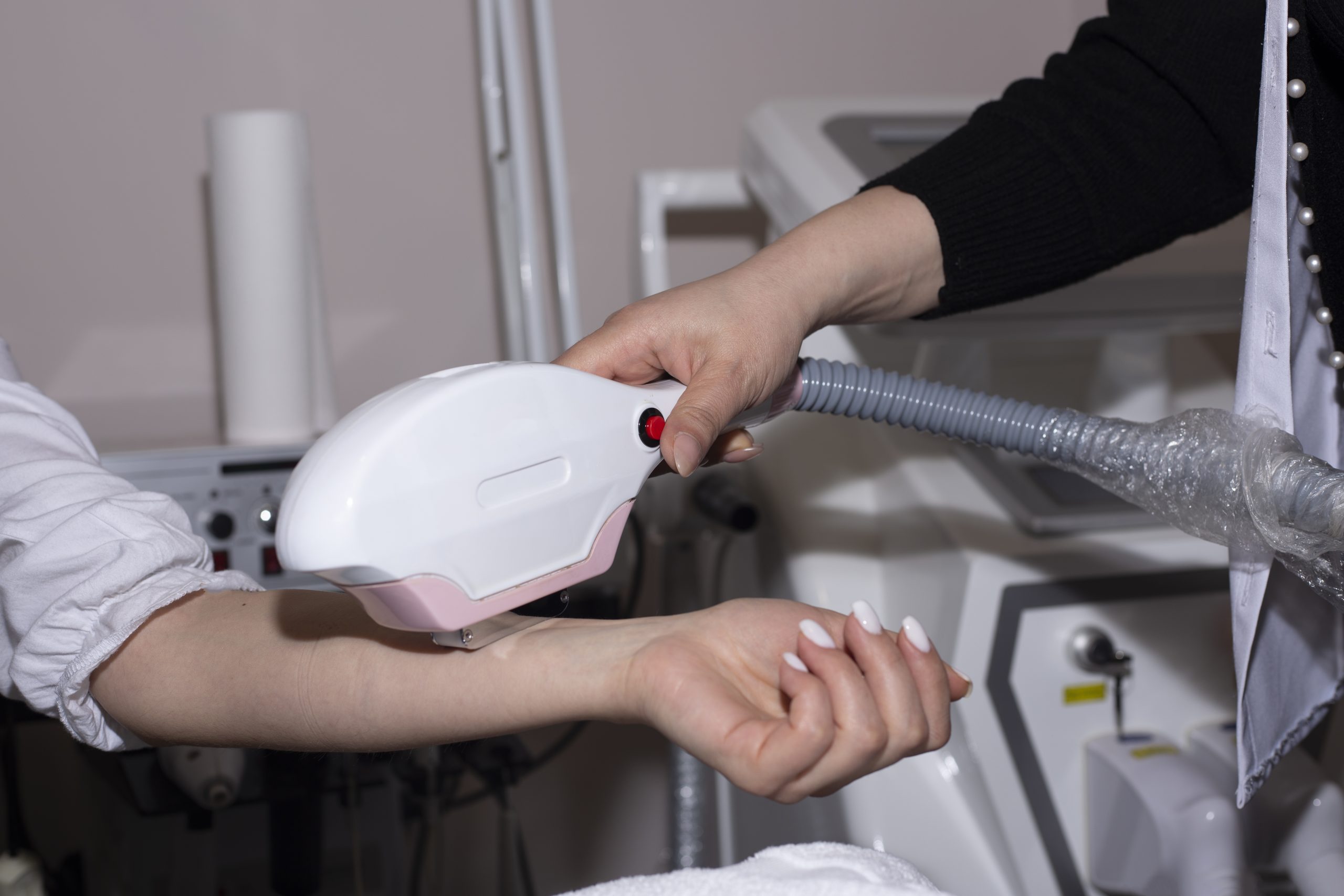 elos-epilation-hair-removal-procedure-woman-s-body-scaled