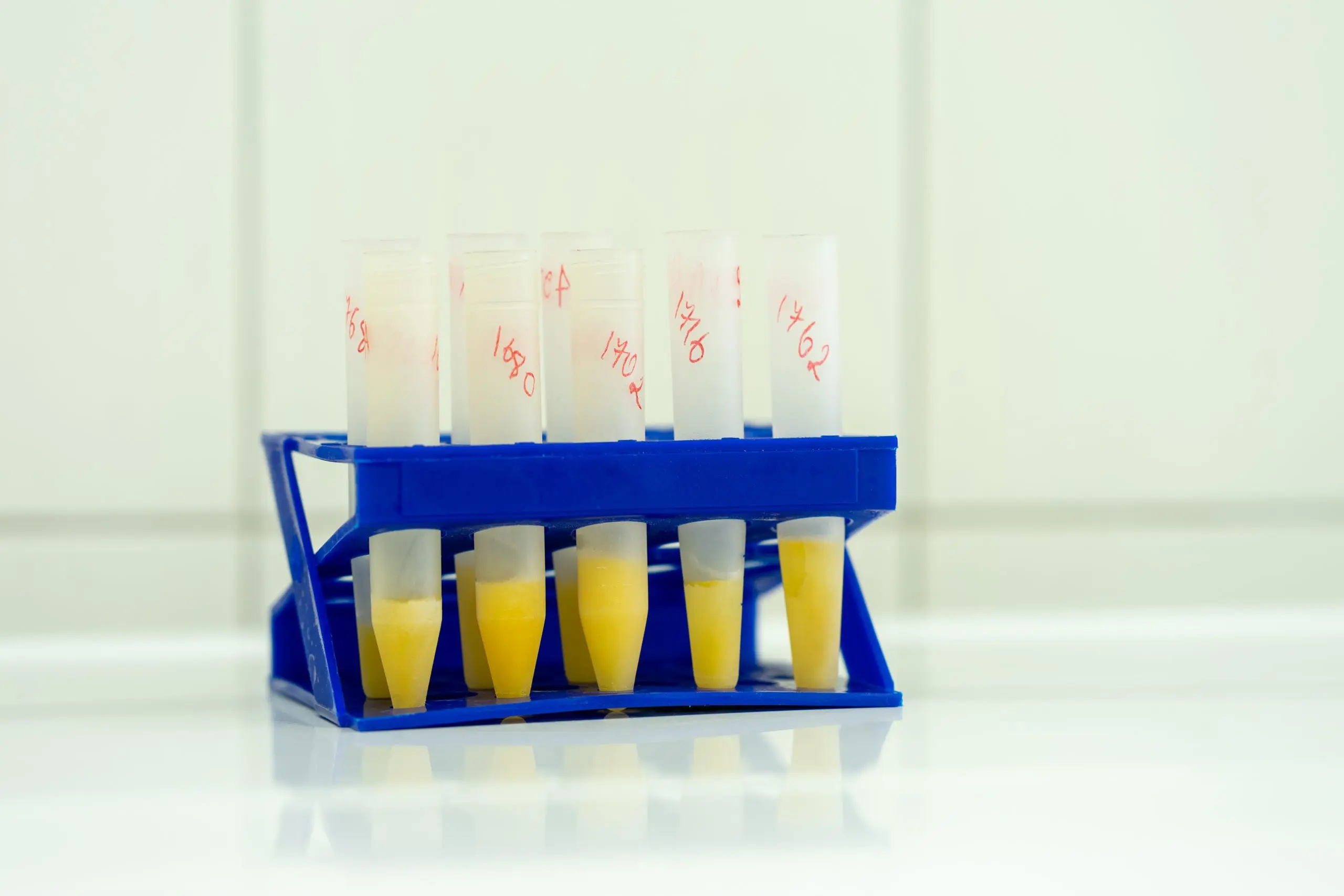 USA Urine Analyzers Equipment Market Outlook 2035 flasks-blood-analysis-stand-scaled