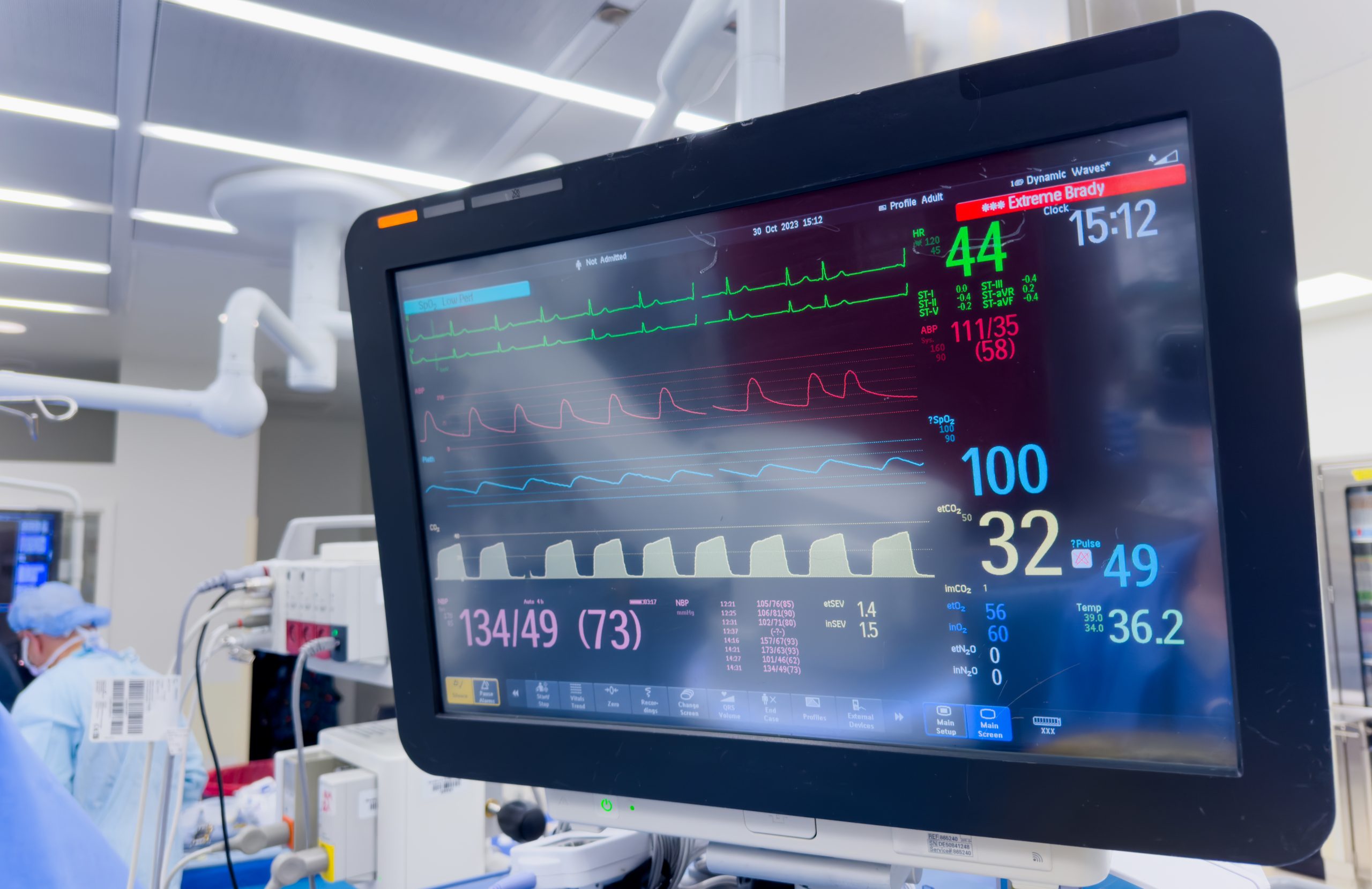 USA Multi-Parameter Patient Monitors Market Outlook 2035 hospital-monitor-displaying-vital-signs-blood-pressure-heart-rate-pulse-oximetry-temperature-scaled