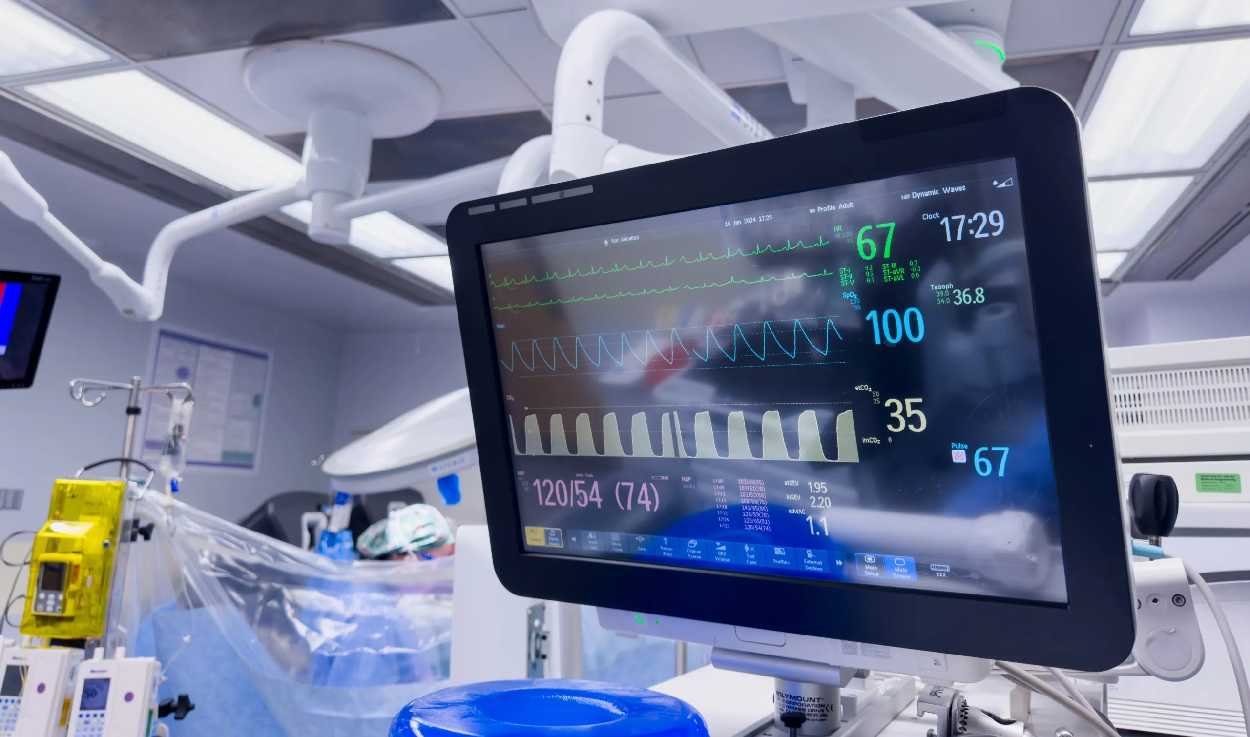 KSA ICP Monitors Equipment Market Outlook 2035 hospital-monitor-displaying-vital-signs-emphasizing-healthcare-technology-patient-wellbeing-scaled