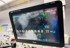 UAE Heart Rate Monitors Equipment Market Outlook 2035