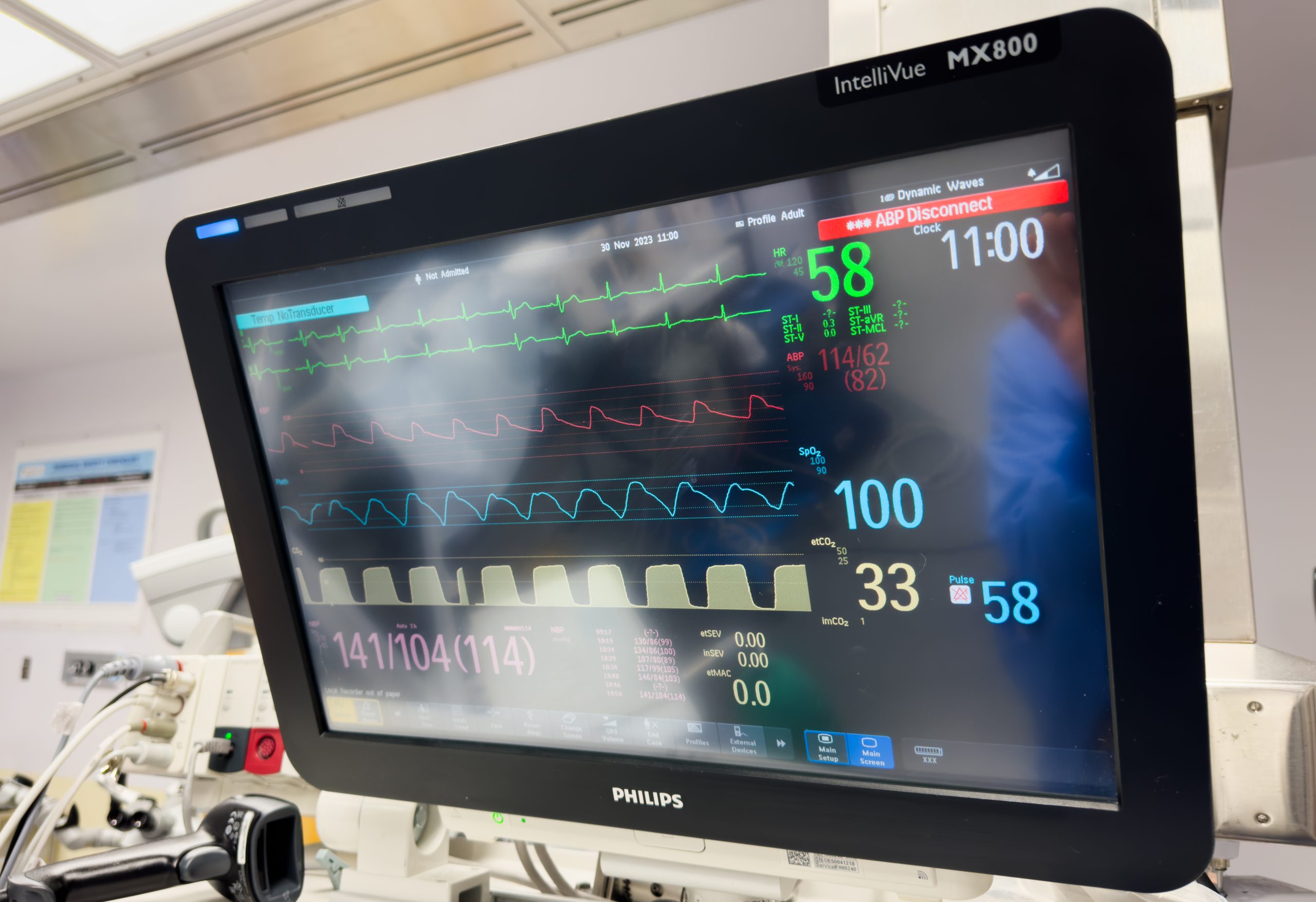 hospital-monitors-display-vital-signs-hemodynamics-heart-rate-blood-pressure-temperature-oxygen-scaled
