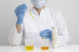 USA Urine Test Strips Market Outlook 2035
