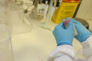 USA Urine Sediment Microscopes Market Outlook 2035