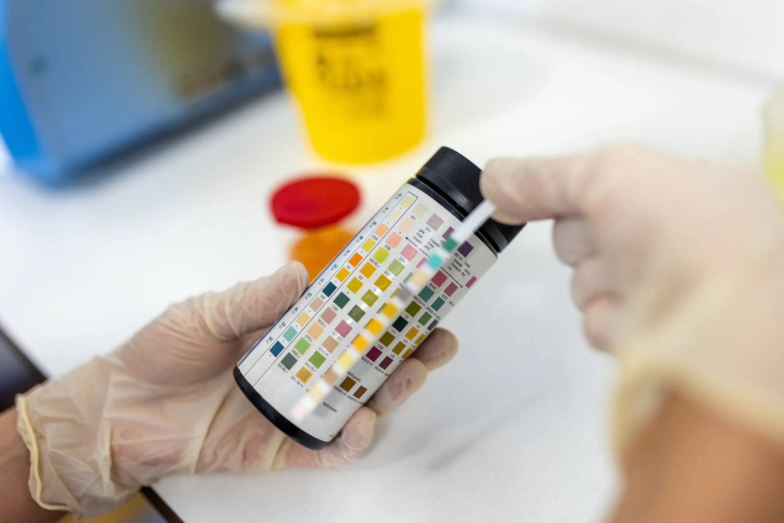 USA Urine pH Meters Market Outlook 2035 reagent-strip-urinalysis-routine-urinalysis-checkup-analysis-laboratory-medical-report-urine-test-strips-scaled