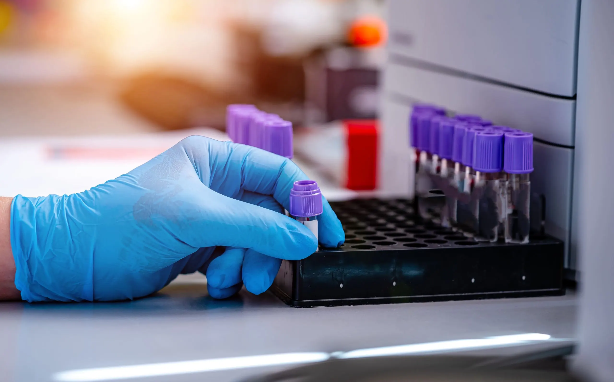 UAE Diagnostic Labs Market to Cross USD 1.5 Billion as Testing Volumes Expand Beyond 6.7% CAGR UAE-diagnostic-labs-industry-scaled