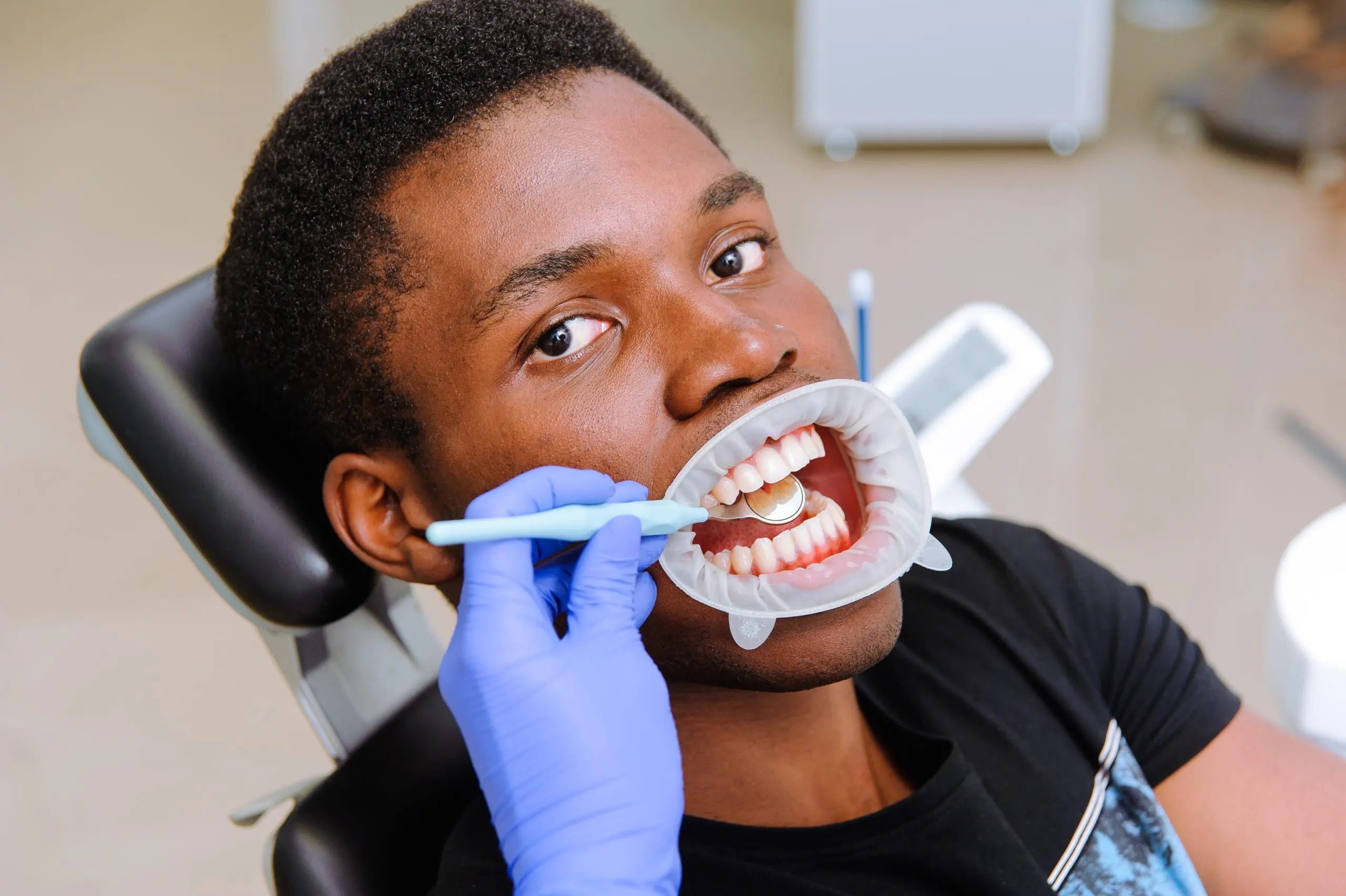 Nigeria Teeth Whitening Market Gains Momentum with Over 7 Percent Growth in Whitening Products Segment african-male-patient-getting-dental-treatment-dental-clinic-scaled