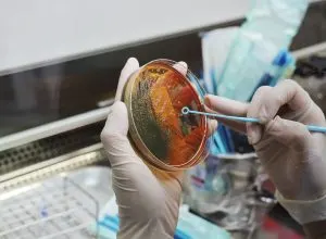Philippines Microbial Food Culture Market Outlook to 2035