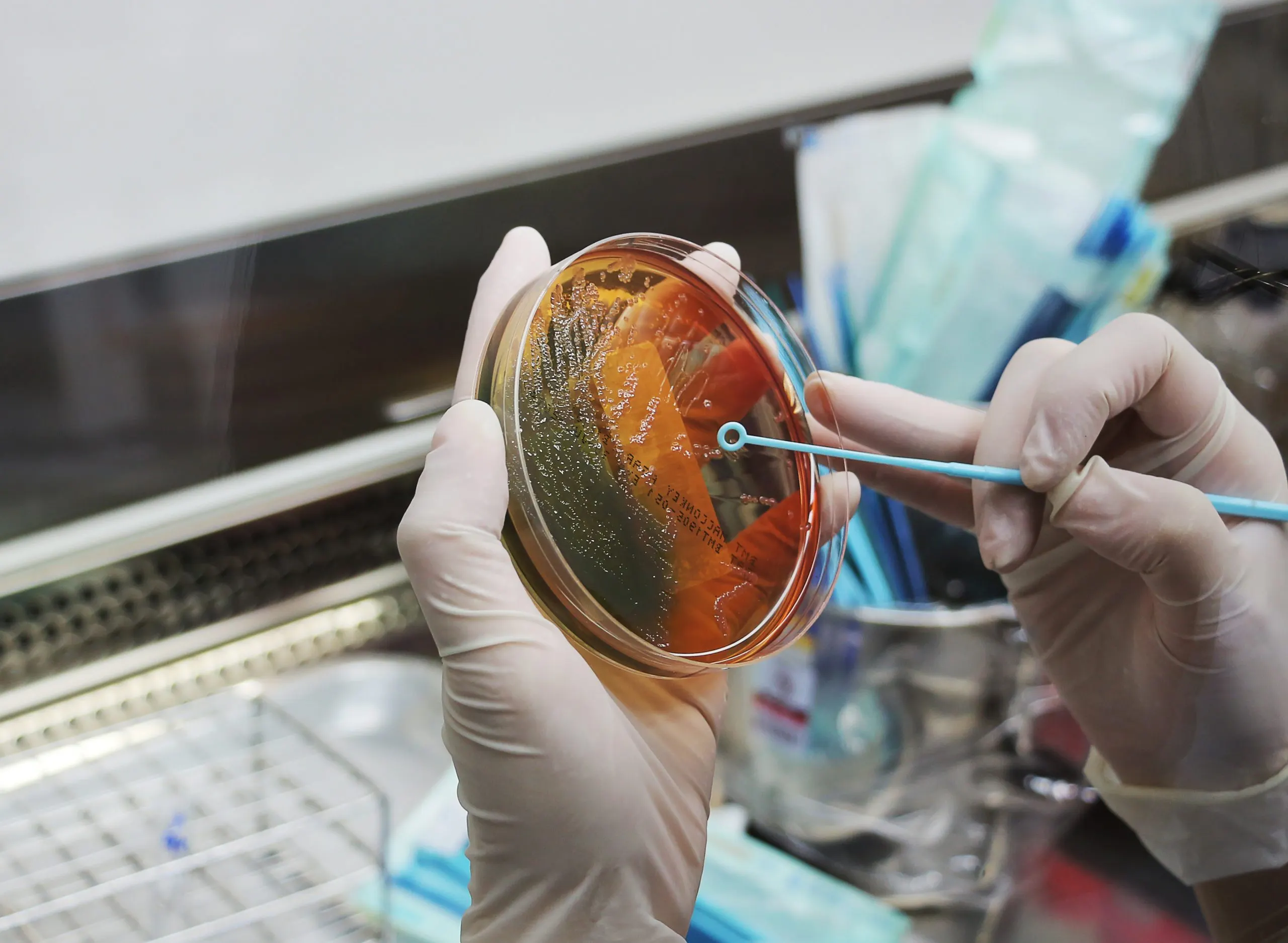 Philippines Microbial Food Culture Market Outlook to 2035 scientists-are-holding-bacterial-culture-plate-scaled