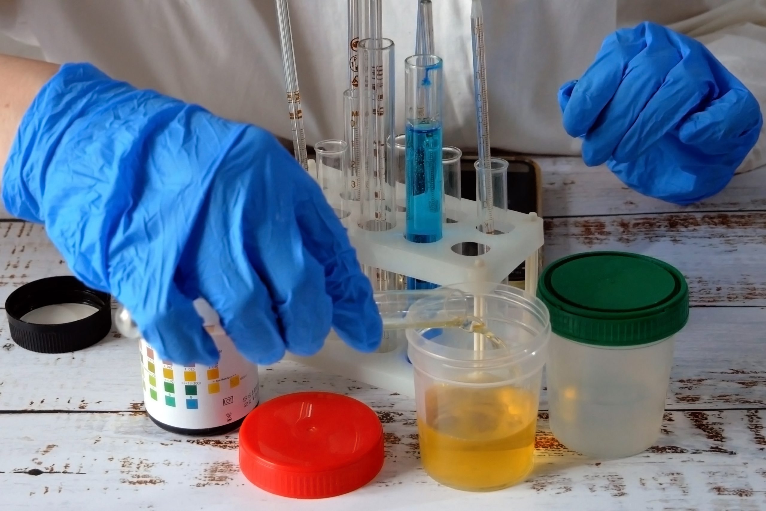 Vietnam Crosslinking Agents Market Outlook to 2035 medical-laboratory-assistant-taking-test-tube-with-liquids-test-with-urine-scientist-doctor-looking-sample-test-tube-laboratory-analysis-closeup-scaled